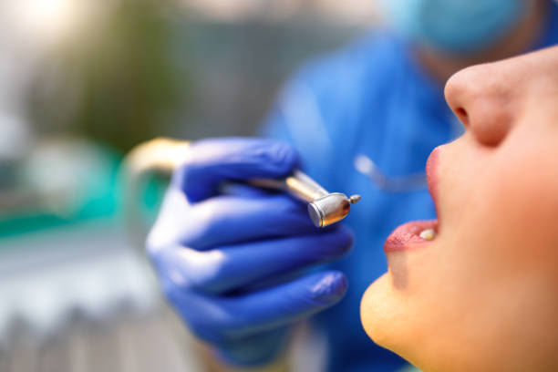 Best Teeth Whitening  in Summit, WA